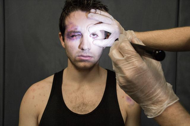 i-arnitiki-pleura-tou-box-5